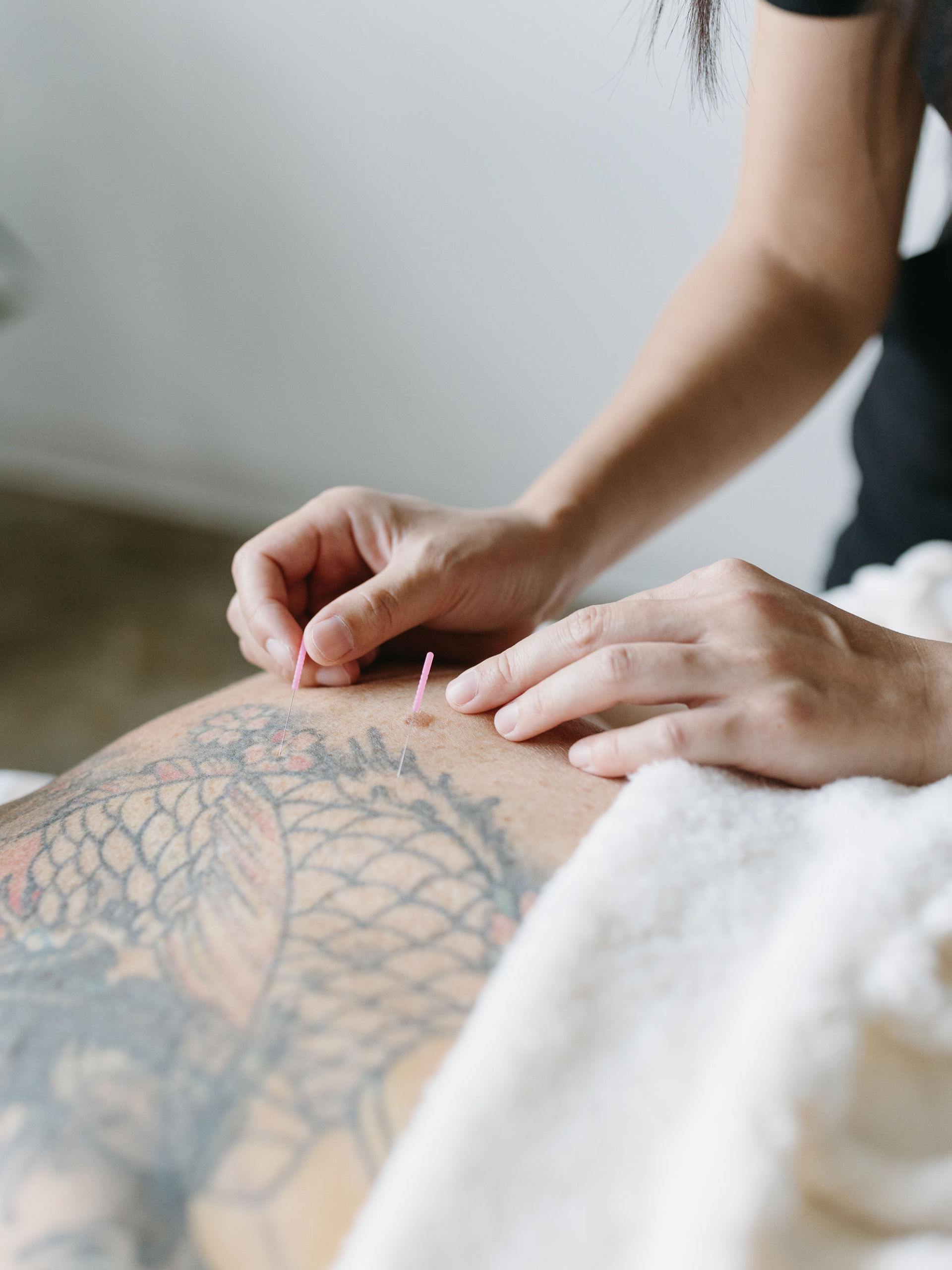Cherry Blossom Healing Arts Acupuncturist giving an acupuncture treatment